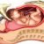 sezeryan – Beylikdüzü Escort sezeryan